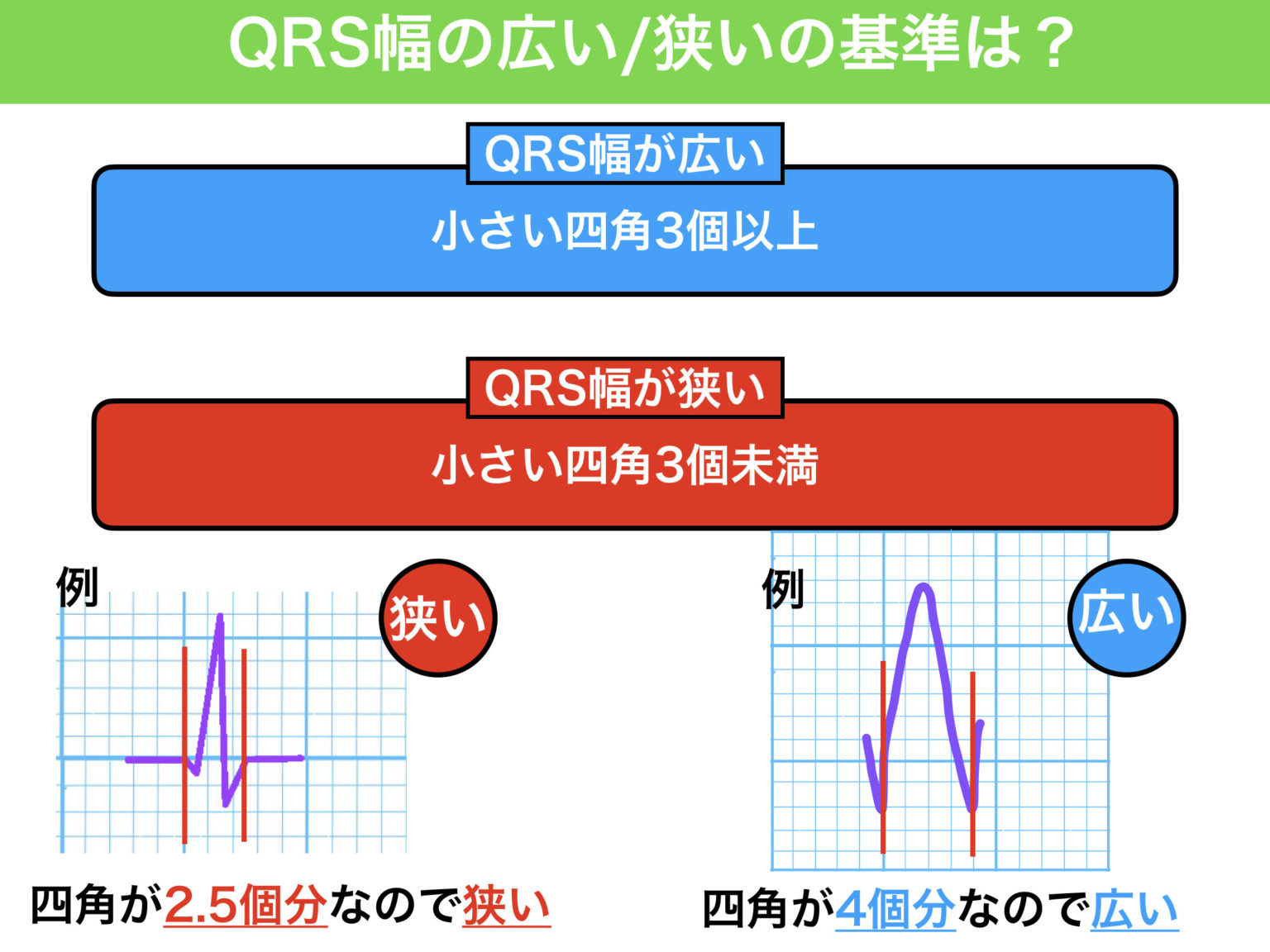 Qrs