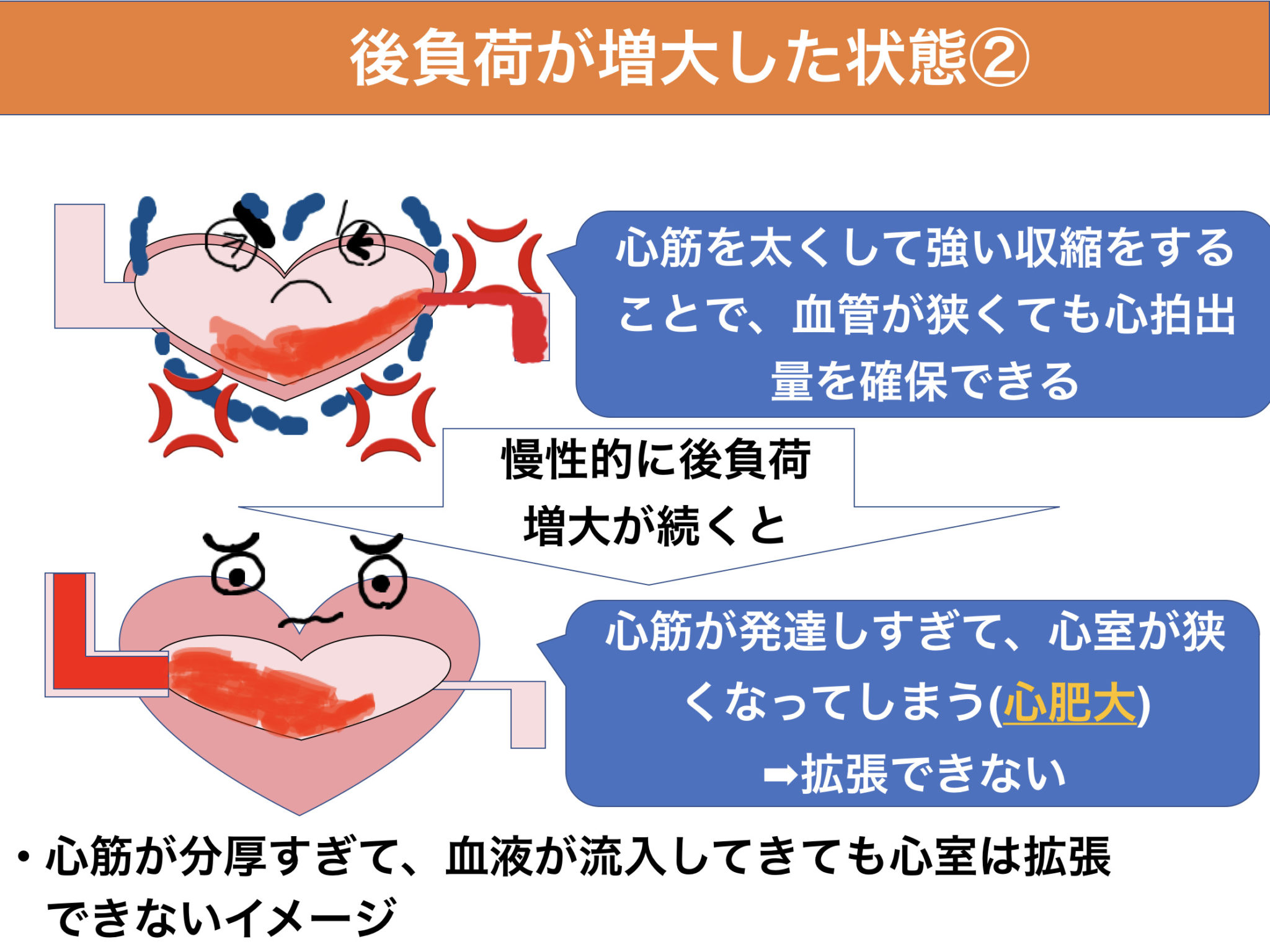 心不全に出てくる前負荷とは？後負荷とは？わかりやすくイラストで解説！