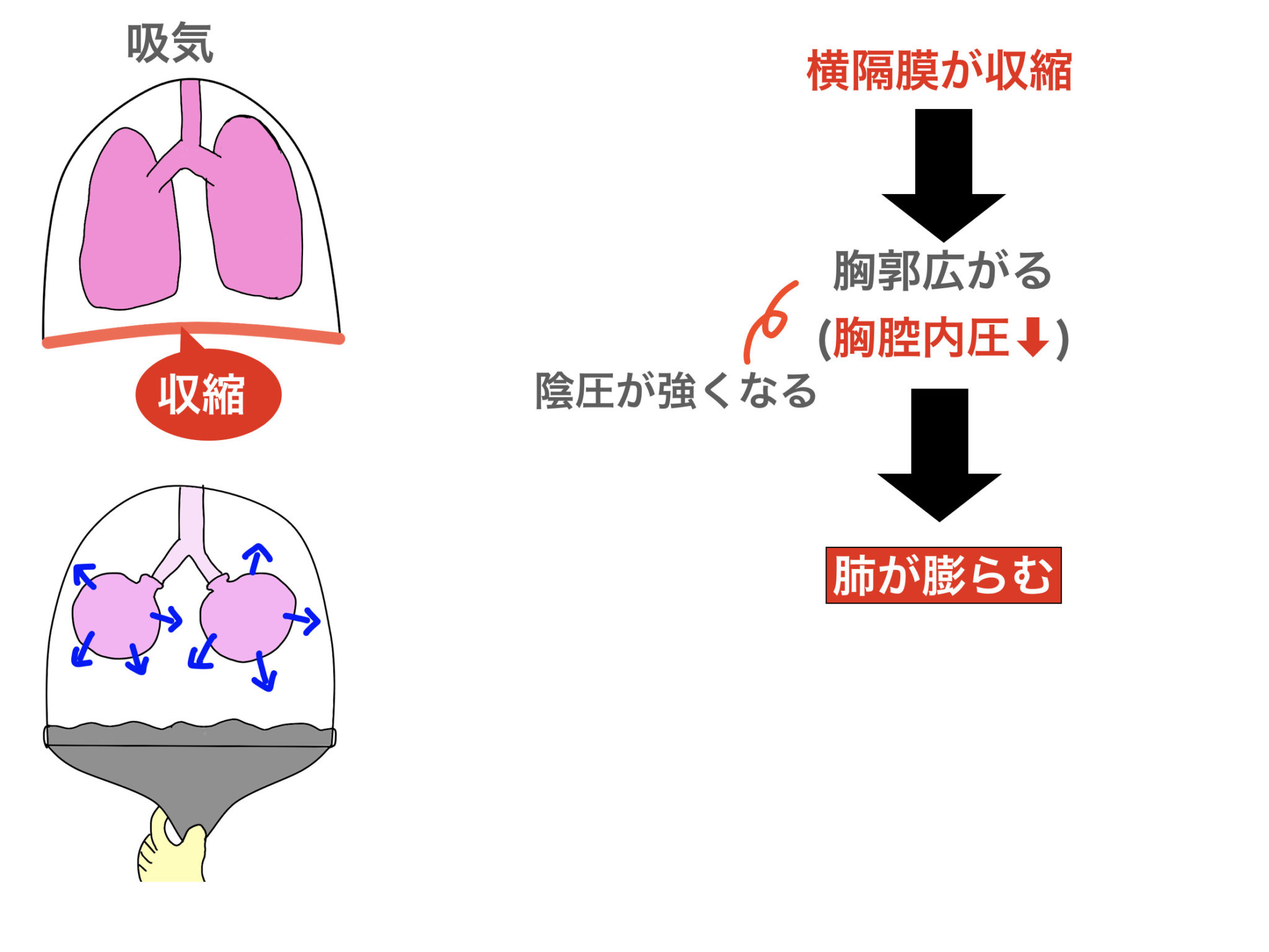 PEEPで静脈還流が低下する仕組みをイラストで解説！〜人工呼吸や陽圧換気って何？〜