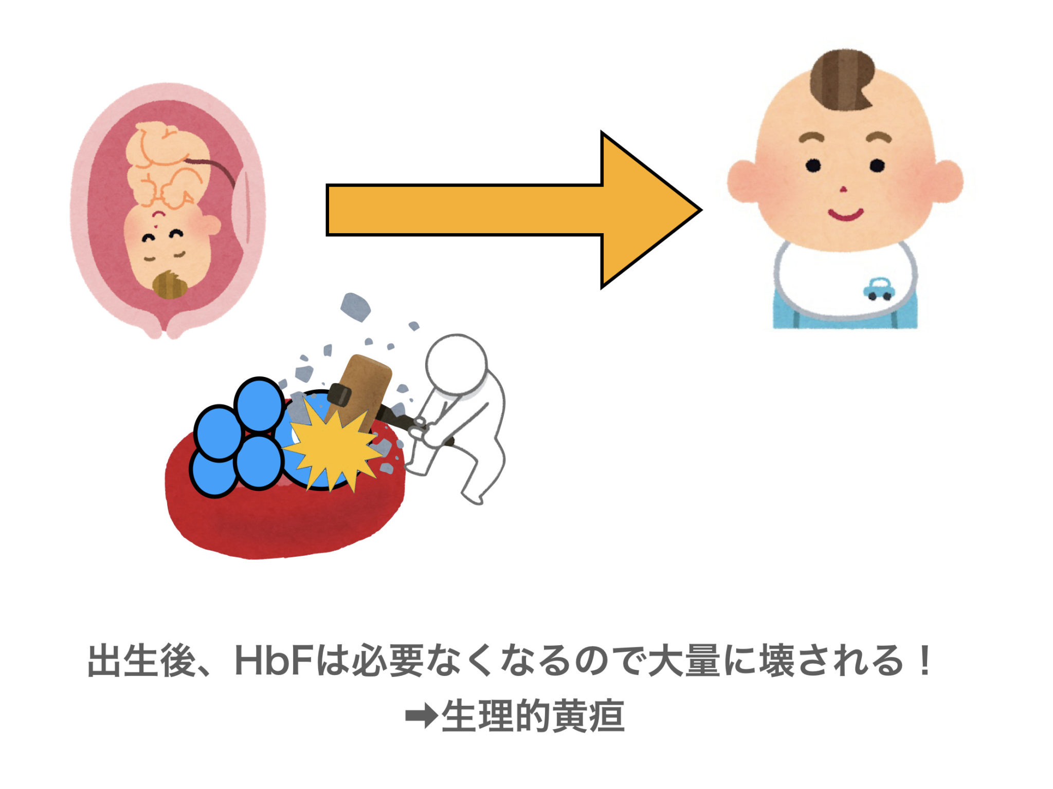 生理的黄疸の原因とは？ピークの日数や病態をわかりやすく解説！