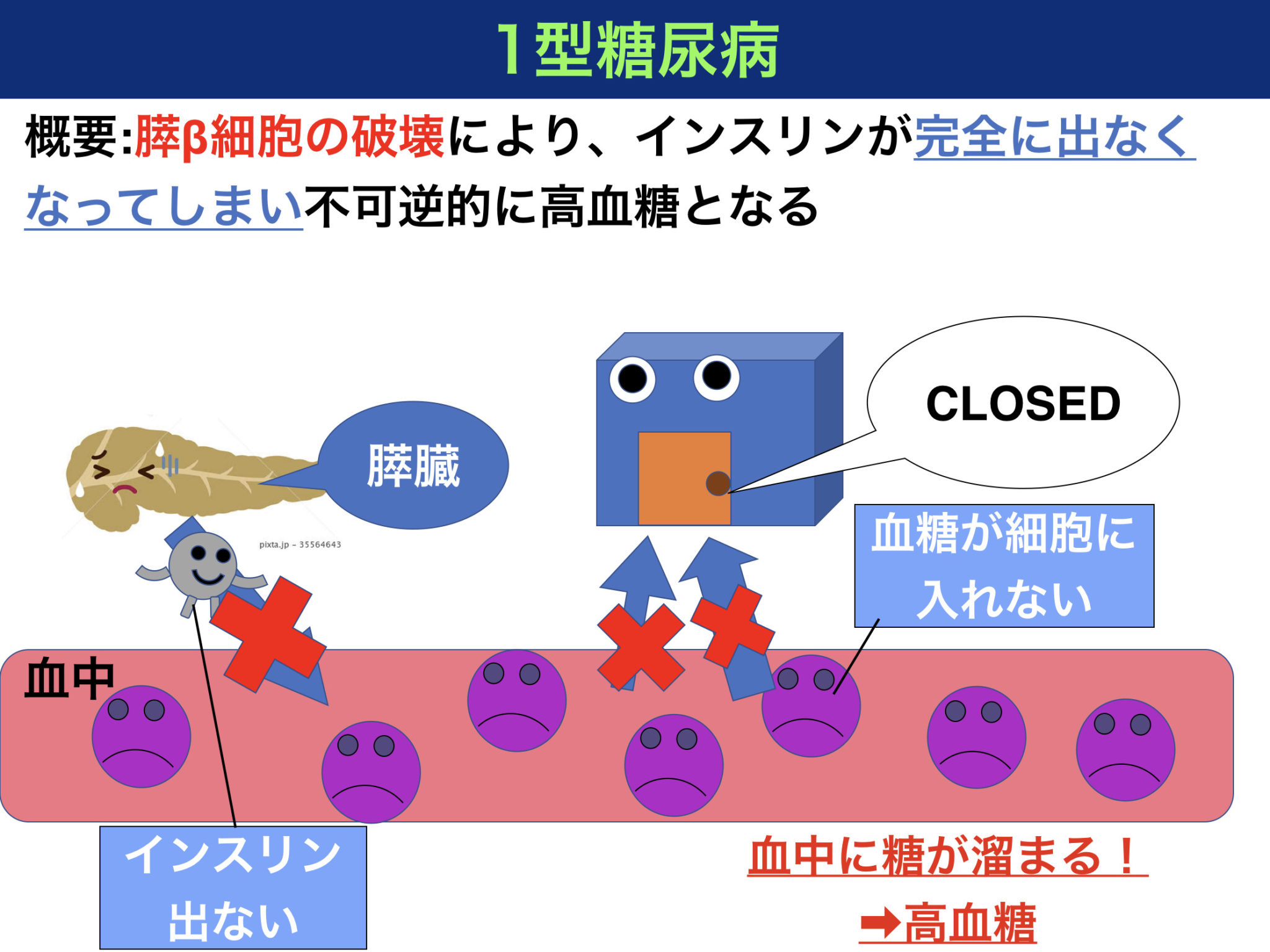 糖尿病ケトアシドーシスとは？機序や症状、病態をわかりやすく解説！