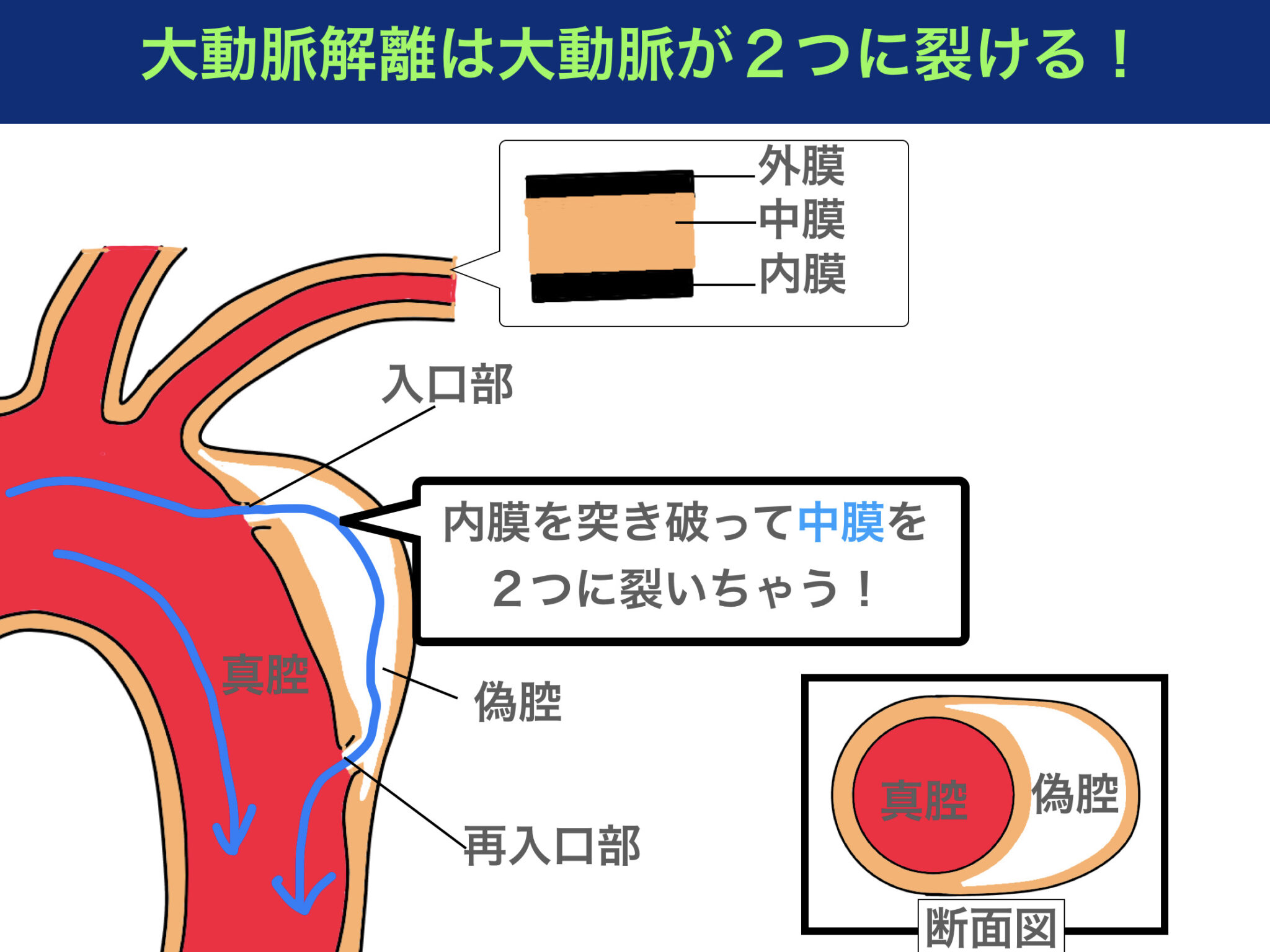 カーボンニュートラル 法律